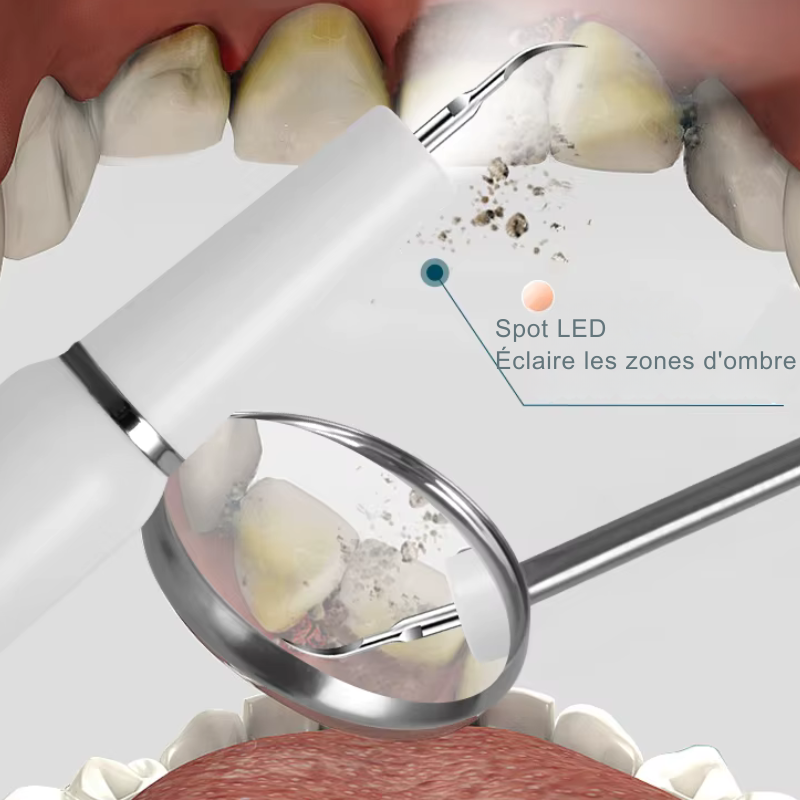 Detartreur Dentaire avec une led pour éclairer l'intérieur de la bouche